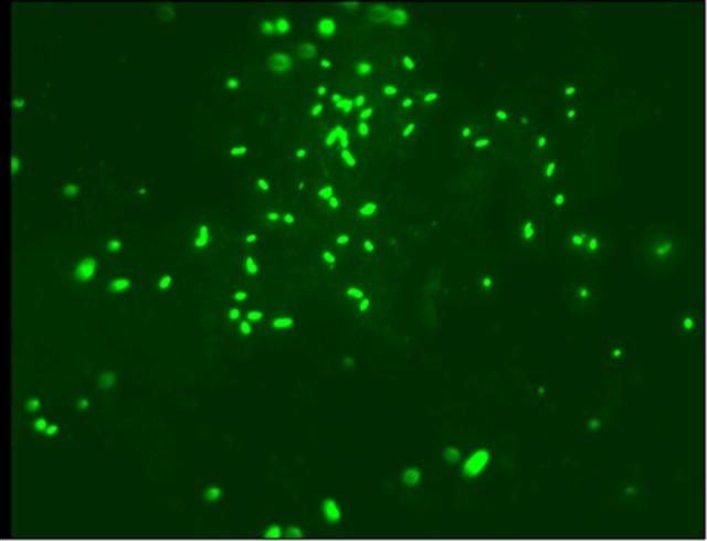 Microscopic image of bacteria in water.