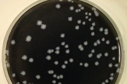 2017, the year of Legionella pneumophila