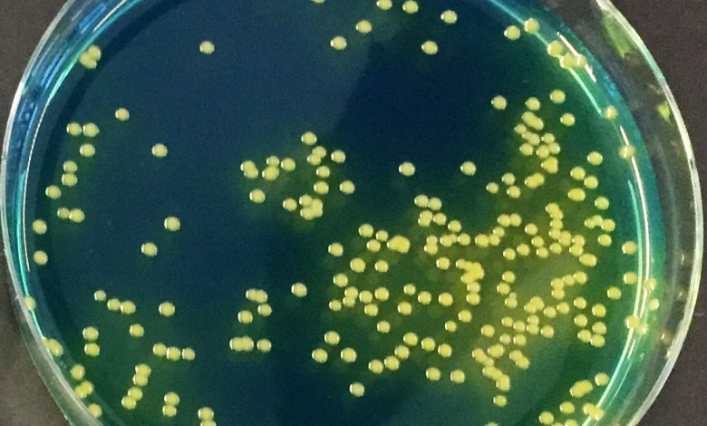 Voedingsbodem met bacteriekolonies van Aeromonas