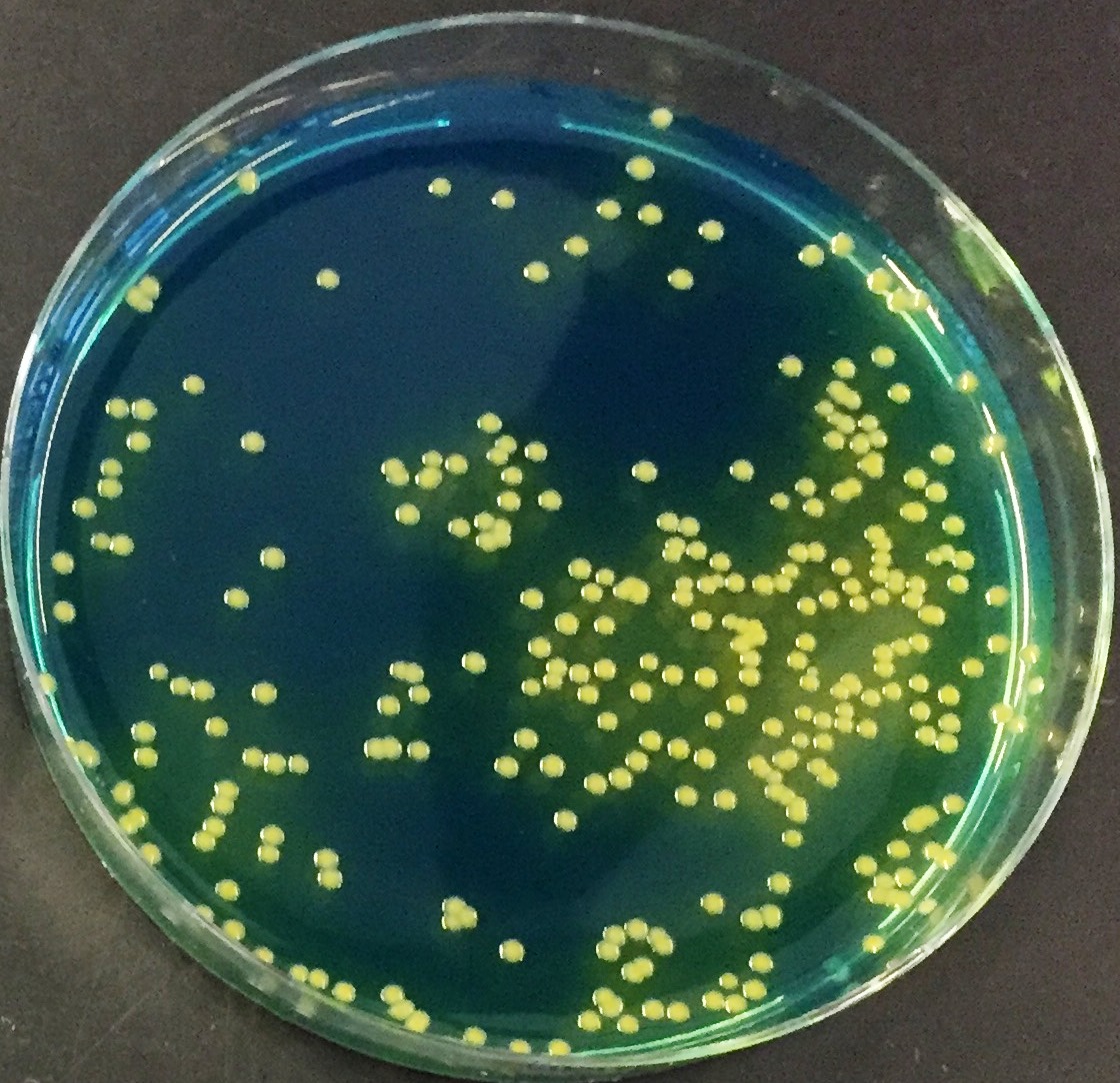 Voedingsbodem met bacteriekolonies van Aeromonas