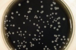 Verschillende oorzaken Legionella-uitbraak in Genesee County (VS) in 2014-2015