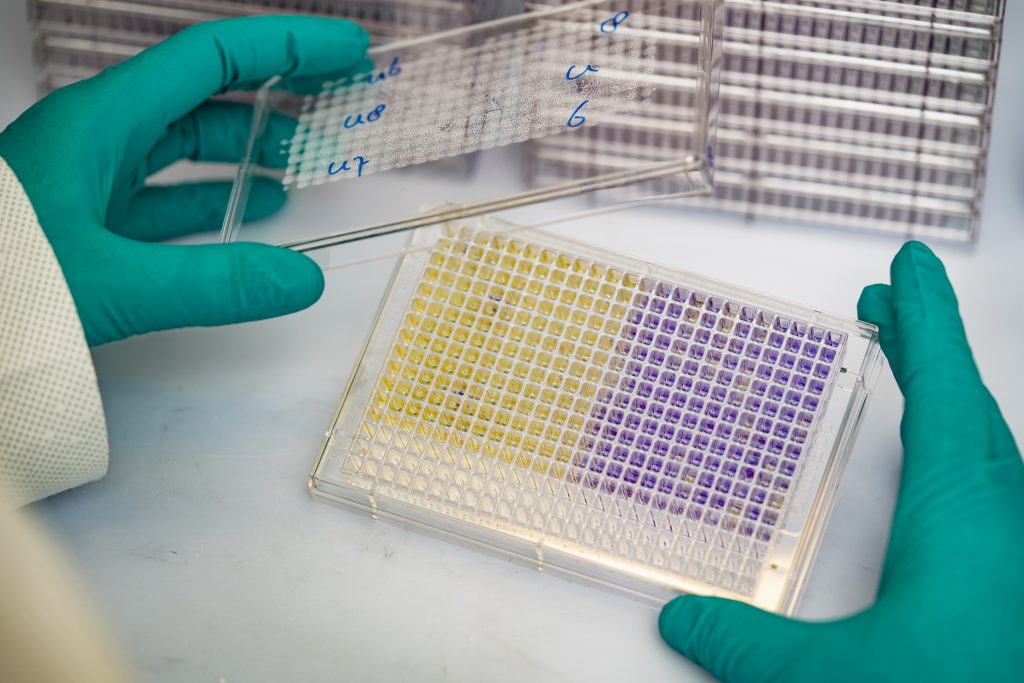 Effectbased waterquality measurements with bioassays KWR